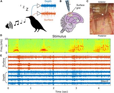 Stimulus Driven Single Unit Activity From Micro-Electrocorticography